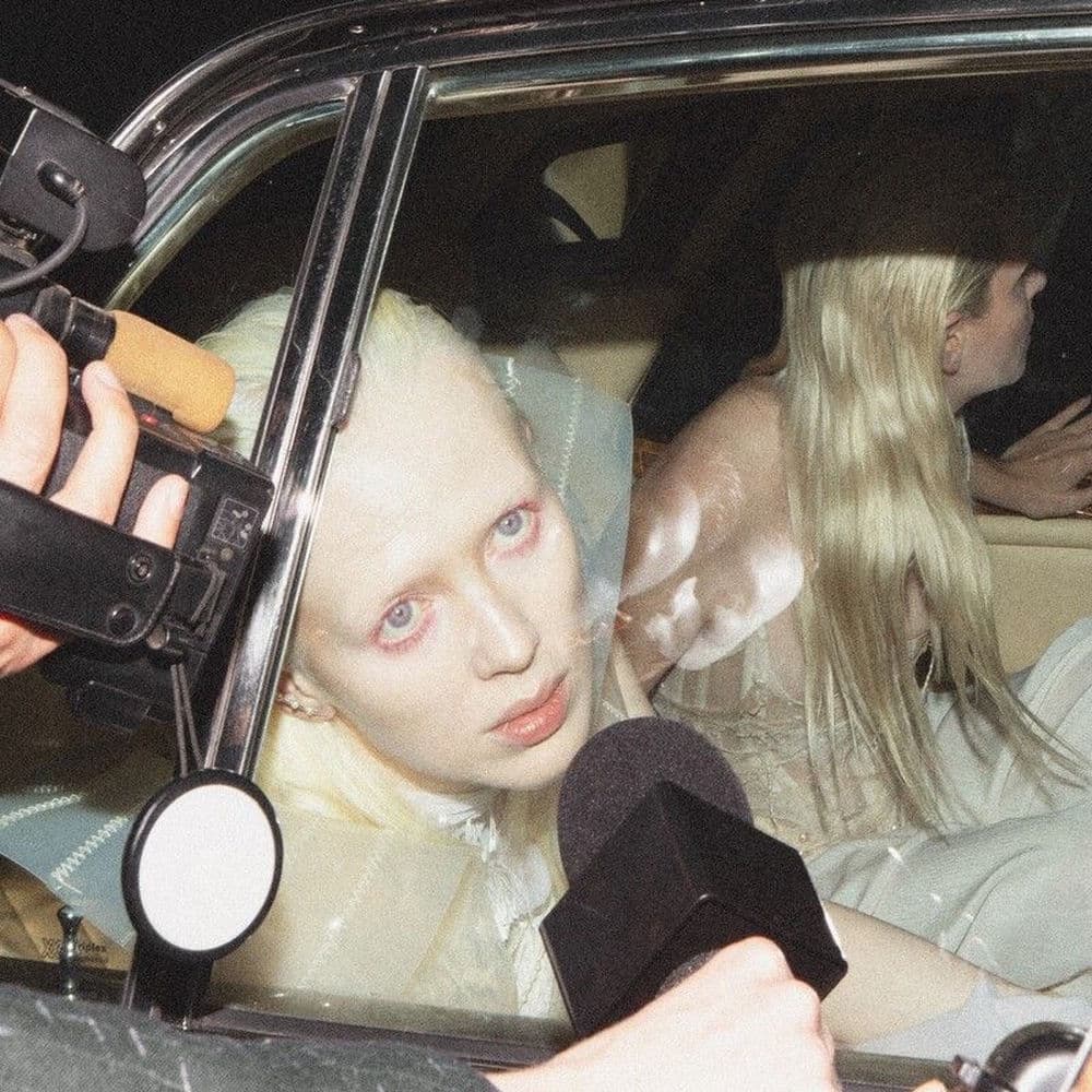 Injury Episode by Static Dress